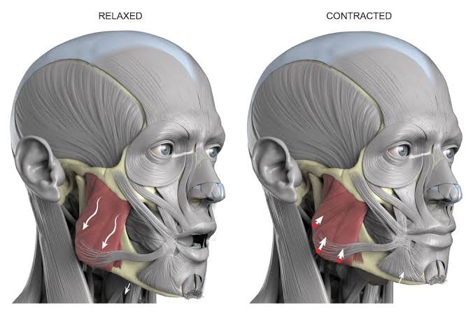 Le masséter, le muscle qui dessine la mâchoire