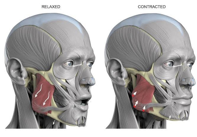 Le masséter, le muscle qui dessine la mâchoire