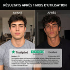 GUMFORCE - Le chewing-gum qui muscle ta mâchoire