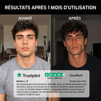 GUMFORCE - Le chewing-gum qui muscle ta mâchoire